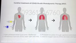 توضیحات دکتر مایکل وبر در خصوص درمان عفونت ویروسی فوتودینامیک تراپی