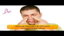 آنچه درباره سینوس باید بدانید