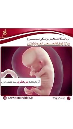 آزمایشات غربالگری سه ماهه اول