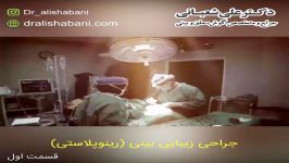 جراحی زیبایی بینی یا رینوپلاستی  دکتر علی شعبانی جراح بینی بابل