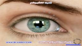 اهمیت خشکی چشم  مرکز چشم پزشکی دکتر علیرضا نادری