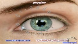 خشکی چشم  مرکز چشم پزشکی دکتر علیرضا نادری