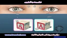 آمبلیوپیتنبلی چشم  مرکز چشم پزشکی دکتر علیرضا نادری
