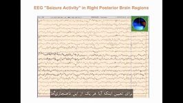 دیدگاهی دیگردر خصوص اختلالات یادگیریAditi Shankardass