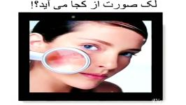 آیا لکهای پوستی نشانه مشکل کبدند؟