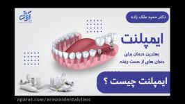 ایمپلنت دندانی چیست ؟ دکتر حمید ملک زاده متخصص جراحی فک صورت 