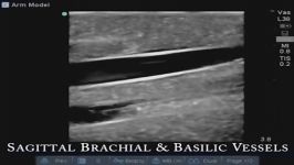 مدل آموزشی دست برای دسترسی عروقی در سونوگرافی
