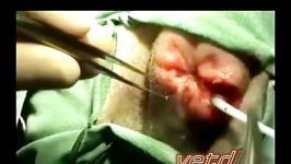 جراحی کیسه مقعدی anal sac surgery