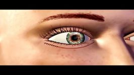 eyelid surgery animation by dr.emami