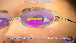 لنز تماسی پیرچشمی  مرکز چشم پزشکی دکتر علیرضا نادری