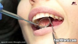علت اصلی پوسیدگی دندان