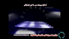 لیزرپیرچشمی اینتراکور  مرکز چشم پزشکی دکتر نادری