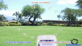 کراتوپلاستی هدایتی  مرکز چشم پزشکی دکتر علیرضا نادری