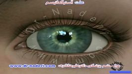 علت آستیگماتیسم مرکز چشم پزشکی دکتر علیرضا نادری