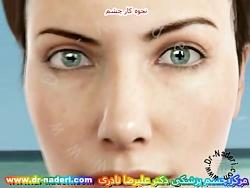 نحوه کار کره چشم مرکز چشم پزشکی دکتر علیرضا نادری