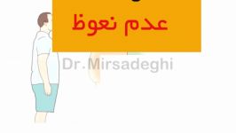 علت های عدم نعوظ در مردان  دکتر میرصادقی