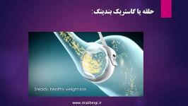 مشاوره اولیه برای بیماران چاقی متابولیک