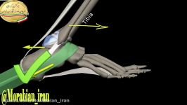 تصحیح حرکت اسکوات بهبود دورسی فلکشن مچ پا