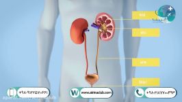 جراحی بسته سنگ کلیه PCNL 2