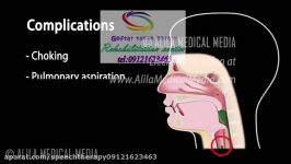 کلینیک تاخیر در گفتار کودک 09121623463   عظیمیه خیابان طالقانی گلستان۲۱