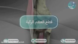 knee osteotomy in atrina