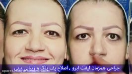 جراحی زیبایی بینی پلک توسط دکتر امید ابراهیمی بهترین جراح زیبایی تهران