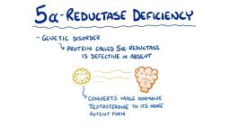 سیستم درون ریز فقدان آنزیم 5 آلفا ردوکتاز علل، علائم، تشخیص درمان