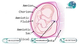 amniotic tissue transplant in atrina