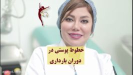 خطوط پوستی در دوران بارداری