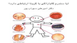 ارتباط سندرم کاوازاکی کرونا دکتر امیرعلی سهراب پور