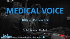 Medical voice LBBB vs. LVH on ECG