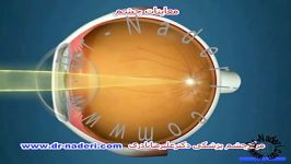 اهمیت معاینات چشم مرکز چشم پزشکی دکتر علیرضا نادری