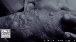 روایتی بمباران شیمیایی «نژمار» در اواخر جنگ