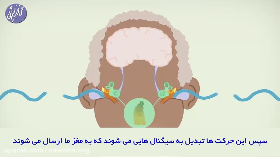 معرفی کم شنوایی حسی عصبی راهکارهای درمان  زیرنویس فارسی