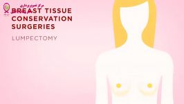 سرطان پستان  قسمت بیست سوم  حفظ بافت پستان