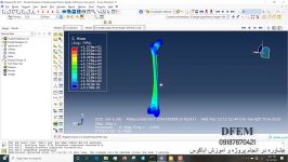 تحلیل استخوان فمور در اباکوس