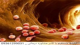 درمان گرفتگی عروق بدون نیاز به آنژیوگرافی