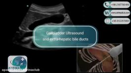 Gallbladder Ultrasound and extra hepatic bile ducts in atrina