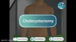 cholecystectomy in atrina