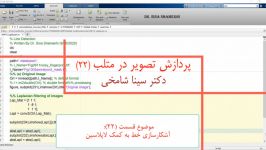 آموزش پردازش تصویر در Matlab قسمت 22 آشکارسازی خط لاپلاسین دکتر سینا شامخی