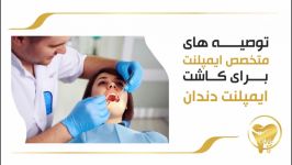 توصیه های متخصص ایمپلنت برای کاشت ایمپلنت دندان