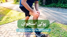 پوکی استخوان علل تا علائم تا روش درمان خانگی