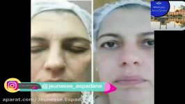 نگاهی به محصولات ژنس