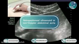 Retroperitoneal ultrasound or non Doppler abdominal aorta in atrina