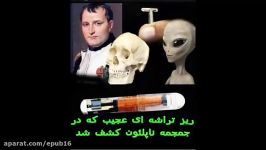 راز تراشه نیم اینچی عجیب در جمجمه ناپلئون I پرشین پلاس بخش عجیب ها