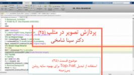 آموزش پردازش تصویر در Matlab قسمت 25 تبدیل Top Hat دکتر سینا شامخی