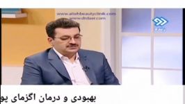 نشانه ها علائم بیماری اگزما روش درمان آن