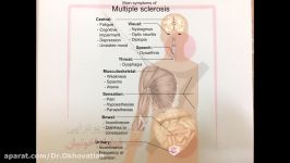 multiple sclerosis or MS مالتیپل اسکلروزیس یا ام اس