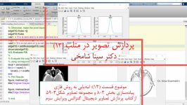 آموزش پردازش تصویر در Matlab قسمت 13 لبه‌یابی فازی دکتر سینا شامخی