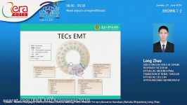 CRUCIAL ROLE OF SERUM RESPONSE FACTOR IN EPITHELIAL MESENCHYMAL TRANSITION OF